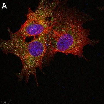 Anti-SLC19A1 Antibody, clone 2E11 ZooMAb® Rabbit Monoclonal，25UL，ZRB1461-25UL，Sigma