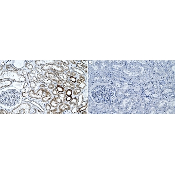 Anti-TCF21 Antibody, clone 2H11 ZooMAb® Rabbit Monoclonal，254G，ZRB2589-25UL，Sigma