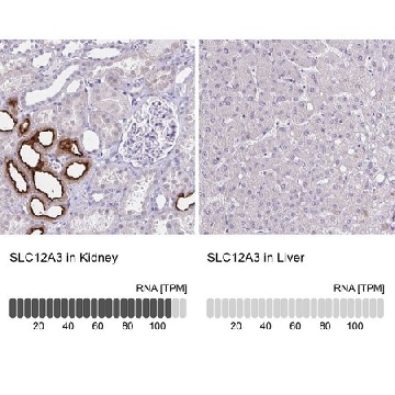 Anti-SLC12A3 antibody produced in rabbit，100UL，HPA028748-100UL，Sigma