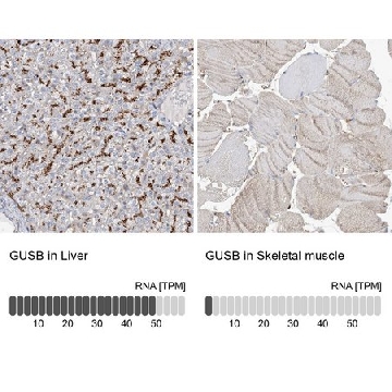 Anti-GUSB antibody produced in rabbit，100UL，HPA036322-100UL，Sigma