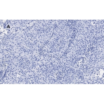 Anti-p21 Antibody, clone 5G7, ZooMAb® Rabbit Monoclonal，25UL，ZRB1141-25UL，Sigma