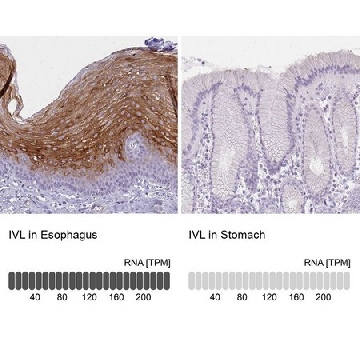 Anti-IVL antibody produced in rabbit，100UL，HPA055211-100UL，Sigma