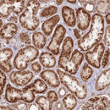 Anti-DGKH antibody produced in rabbit，100UL，HPA040355-100UL，Sigma