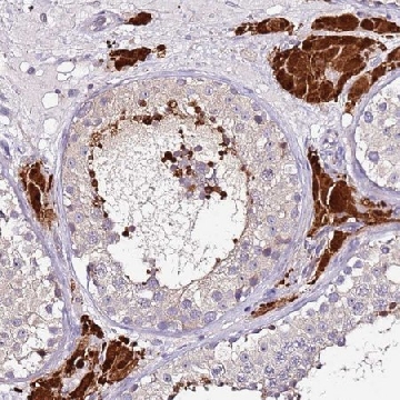 Anti-SRRM5 antibody produced in rabbit，100UL，HPA047399-100UL，Sigma