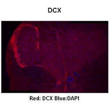 Anti-DCX (AB1) antibody produced in rabbit，100UL，AV41333-100UL，Sigma