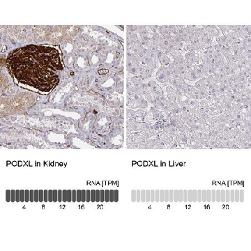 Anti-PODXL antibody produced in rabbit，100UL，HPA002110-100UL，Sigma