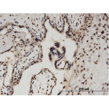 Monoclonal Anti-BCL11A antibody produced in mouse，100UG，SAB1400573-100UG，Sigma