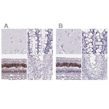 Anti-CRX antibody produced in rabbit，100UL，HPA036763-100UL，Sigma