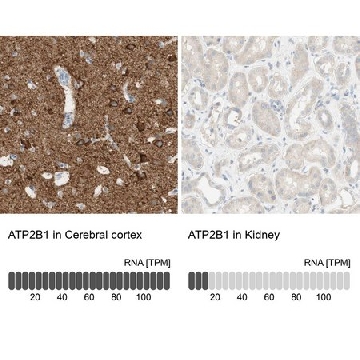 Anti-ATP2B1 antibody produced in rabbit，100UL，HPA011166-100UL，Sigma