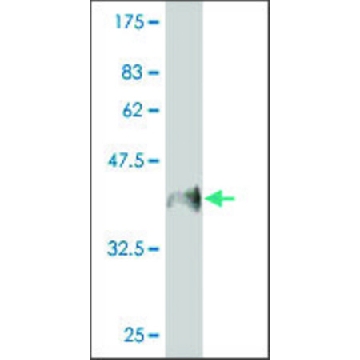 Monoclonal Anti-MUC5B antibody produced in mouse，200UL，SAB1403512-200UL，Sigma