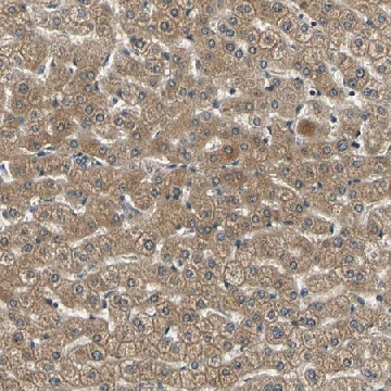 Anti-LPGAT1 antibody produced in rabbit，100UL，HPA008304-100UL，Sigma