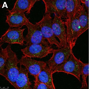 Anti-Linear Ubiquitin Antibody, clone 1E3 ZooMAb® Rabbit Monoclonal，25UL，ZRB2114-25UL，Sigma