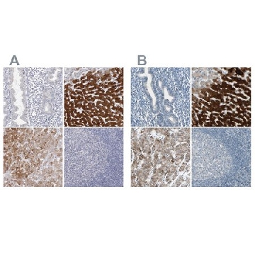 Anti-CYP2E1 antibody produced in rabbit，100UL，HPA029564-100UL，Sigma