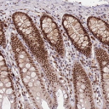 Anti-SMAD9 antibody produced in rabbit，100UL，HPA031162-100UL，Sigma