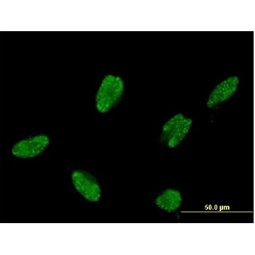 Monoclonal Anti-ASCL1, (C-terminal) antibody produced in mouse，100UG，SAB1403577-100UG，Sigma