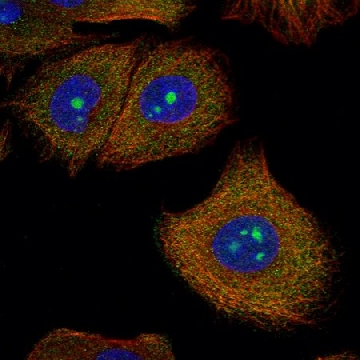 Anti-SPOUT1 antibody produced in rabbit，100UL，HPA022990-100UL，Sigma