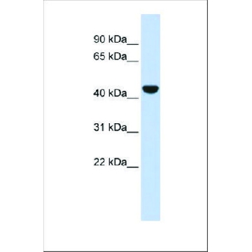 Anti-KRT19 (ab1) antibody produced in rabbit，100UL，SAB2101302-100UL，Sigma