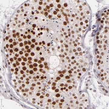 Anti-BRD8 antibody produced in rabbit，100UL，HPA001841-100UL，Sigma