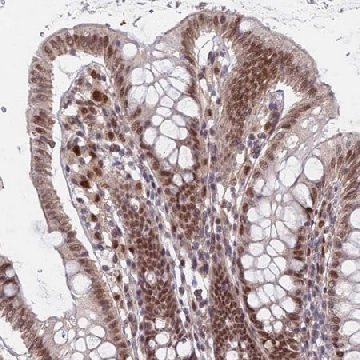 Anti-RPP25 antibody produced in rabbit，100UL，HPA046900-100UL，Sigma