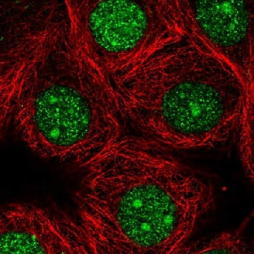 Anti-GMPR2 antibody produced in rabbit，100UL，HPA068782-100UL，Sigma