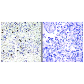 Anti-TEAD2 antibody produced in rabbit，100UG，SAB4503373-100UG，Sigma