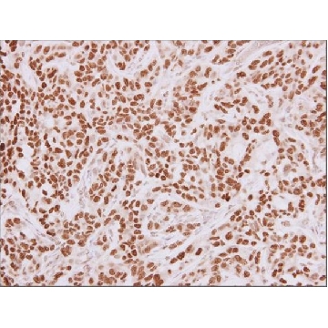 Anti-HMGA2 antibody produced in rabbit，100UL，SAB2701959-100UL，Sigma