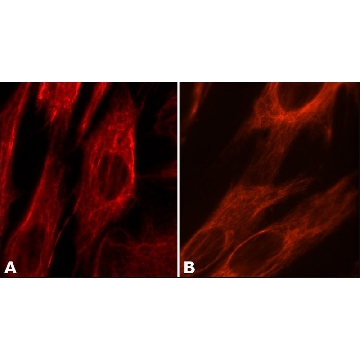Anti-Vimentin antibody, Mouse monoclonal，100UL，SAB4200716-100UL，Sigma