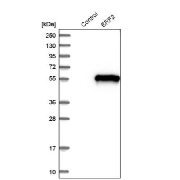Anti-BRF2 antibody produced in rabbit，100UL，HPA023378-100UL，Sigma