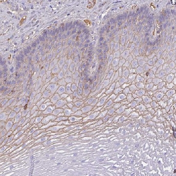 Anti-SMYD5 antibody produced in rabbit，100UL，HPA049002-100UL，Sigma