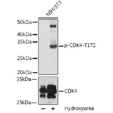 Anti-Phospho-CDK4-T172 antibody produced in rabbit，100UL，SAB5700423-100UL，Sigma