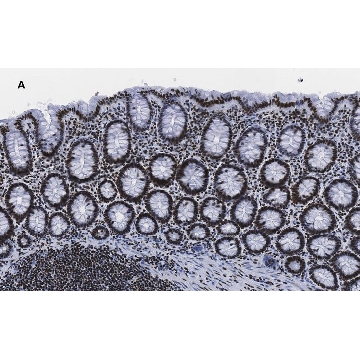 Anti-trimethyl-Histone H3 (Lys4) Antibody, clone MC315, ZooMAb® Rabbit Monoclonal，4X25UL，ZRB04791-4X25UL，Sigma
