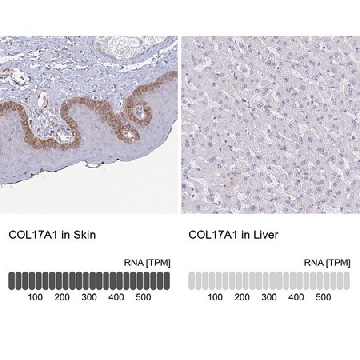 Anti-COL17A1 antibody produced in rabbit，100UL，HPA043673-100UL，Sigma