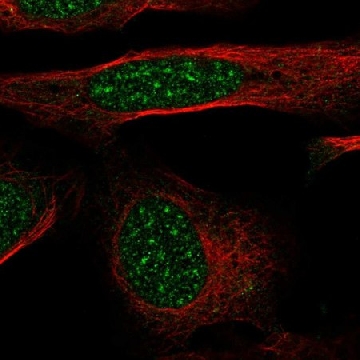 Anti-GTF2H4 antibody produced in rabbit，100UL，HPA074336-100UL，Sigma