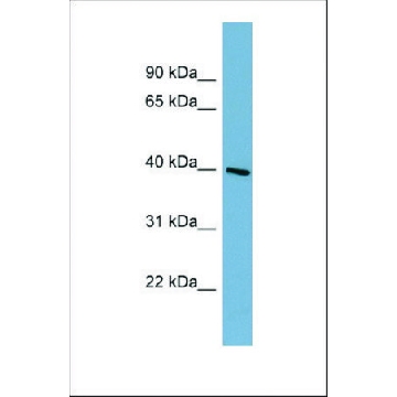 Anti-ST8SIA6 antibody produced in rabbit，100UL，SAB2105579-100UL，Sigma