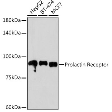 Anti-Prolactin Receptor Antibody, clone 9B10J3, Rabbit Monoclonal，100UL，SAB5702466-100UL，Sigma