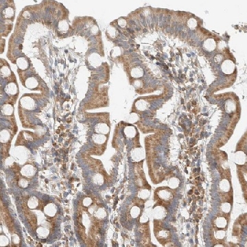 Anti-CCDC57 antibody produced in rabbit，100UL，HPA023344-100UL，Sigma