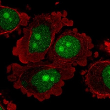 Anti-C8orf59 antibody produced in rabbit，100UL，HPA044805-100UL，Sigma