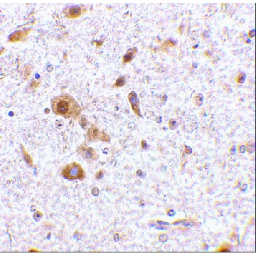 抗-TSLP (ab3) 兔抗，100UG，PRS4025-100UG，Sigma