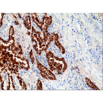 Anti-SP-B (Surfactant protein B) antibody, Rabbit monoclonal，100UL，SAB5600258-100UL，Sigma