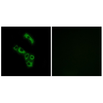 Anti-C1QB, C-Terminal antibody produced in rabbit，100UG，SAB4502986-100UG，Sigma