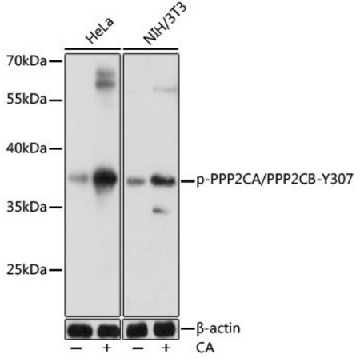 Anti-Phospho-PPP2CA/PPP2CB-Y307 antibody produced in rabbit，100UL，SAB5700546-100UL，Sigma