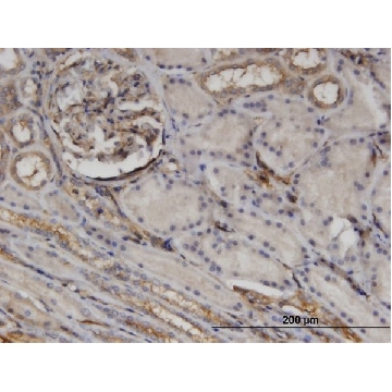 Monoclonal Anti-CTHRC1 antibody produced in mouse，100UG，SAB1402656-100UG，Sigma