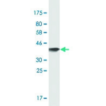 Monoclonal Anti-OSBPL7 antibody produced in mouse，100UG，SAB1408841-100UG，Sigma