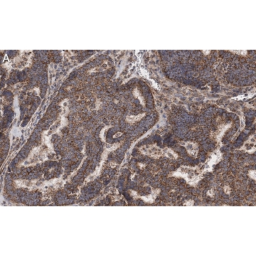 Anti-Beclin 1 Antibody, clone 1E22 , ZooMAb® Rabbit Monoclonal，25UL，ZRB1222-25UL，Sigma