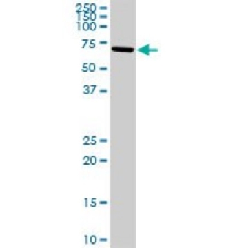 Anti-ALOX15 antibody produced in rabbit，100UG，SAB1410452-100UG，Sigma