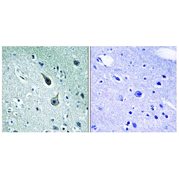Anti-5-HT-2A antibody produced in rabbit，100UG，SAB4501474-100UG，Sigma