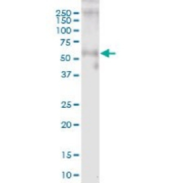 Anti-WFIKKN2 antibody produced in mouse，50UG，SAB1408864-50UG，Sigma