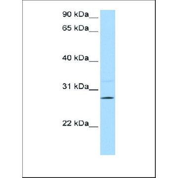 Anti-PEMT antibody produced in rabbit，100UL，AV43558-100UL，Sigma