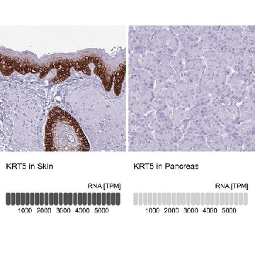 Anti-KRT5 antibody produced in rabbit，100UL，HPA059479-100UL，Sigma