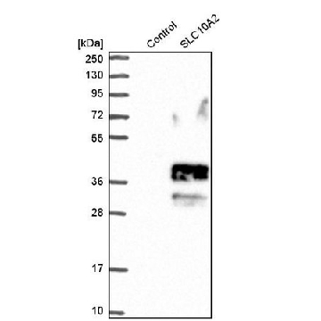 Anti-SLC10A2 antibody produced in rabbit，100UL，HPA004795-100UL，Sigma
